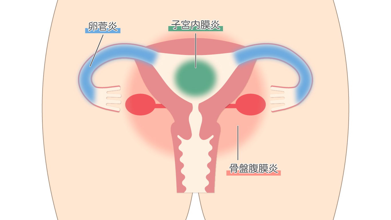 陰部 イカ 臭い