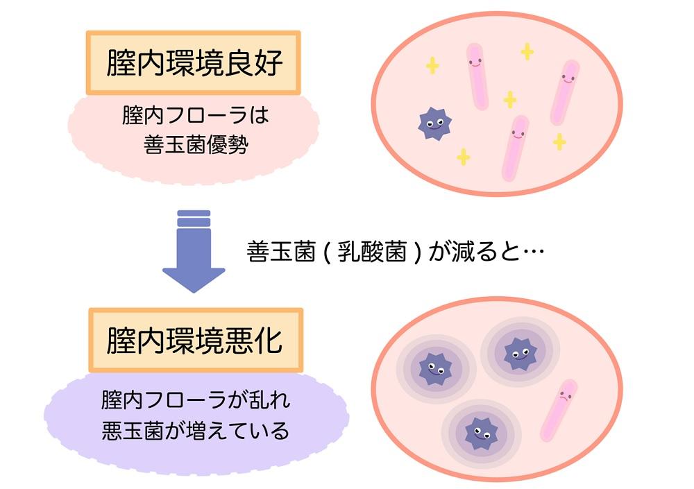 おりものが臭いのは病気？ニオイの原因・対策と病院に行くべきケースを解説｜wakanote