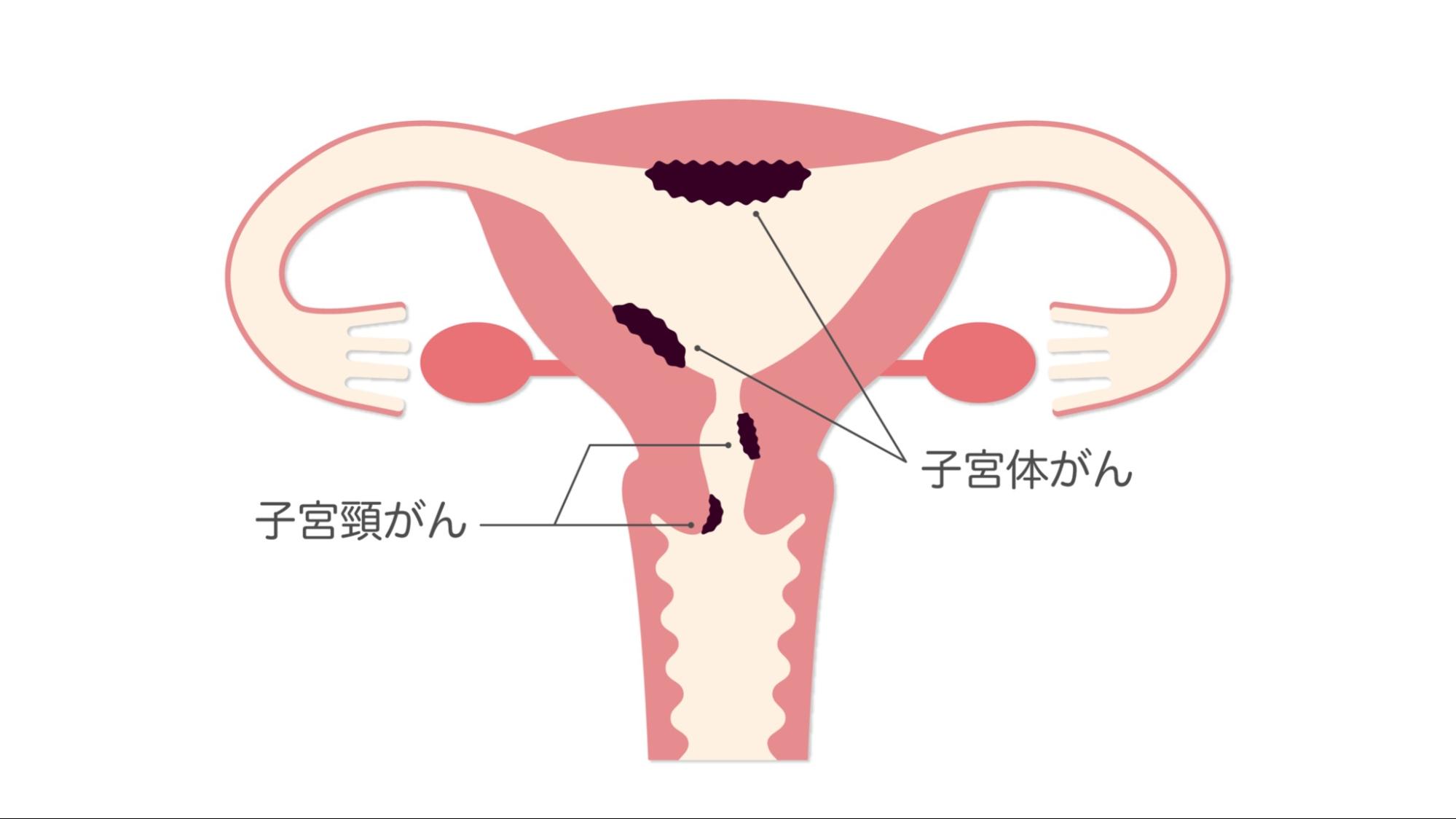 おりものが茶色いのはなぜ？生理前後や妊娠・病気のケースを徹底解説！｜wakanote