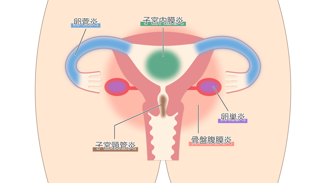 おりものの量が多い原因は？増える時期・病気のサインについても徹底解説！｜wakanote