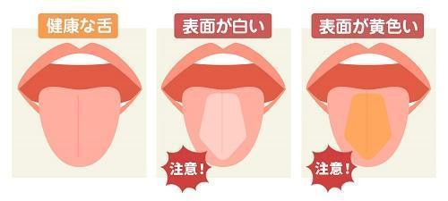 6 口臭を消す 口臭の原因　口臭ケア 口臭チェッカー　口臭SOS　口臭対策 口臭、すぐに無くす方法！ | 野田阪神アルプス歯科公式野田阪神